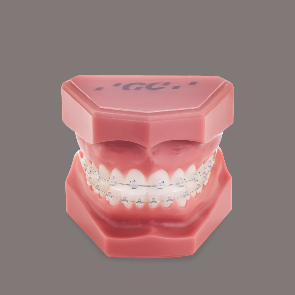 Ortodontilised tooted