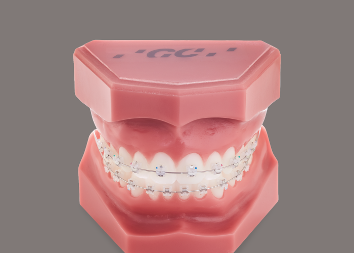 Orthodontic supplies